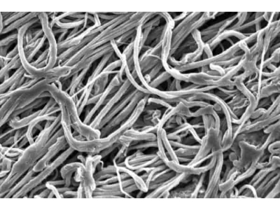 Global Nanofibers Market Scenario Analysis, Trends, Drivers, Leading Players, and Impact Analysis Report by 2028