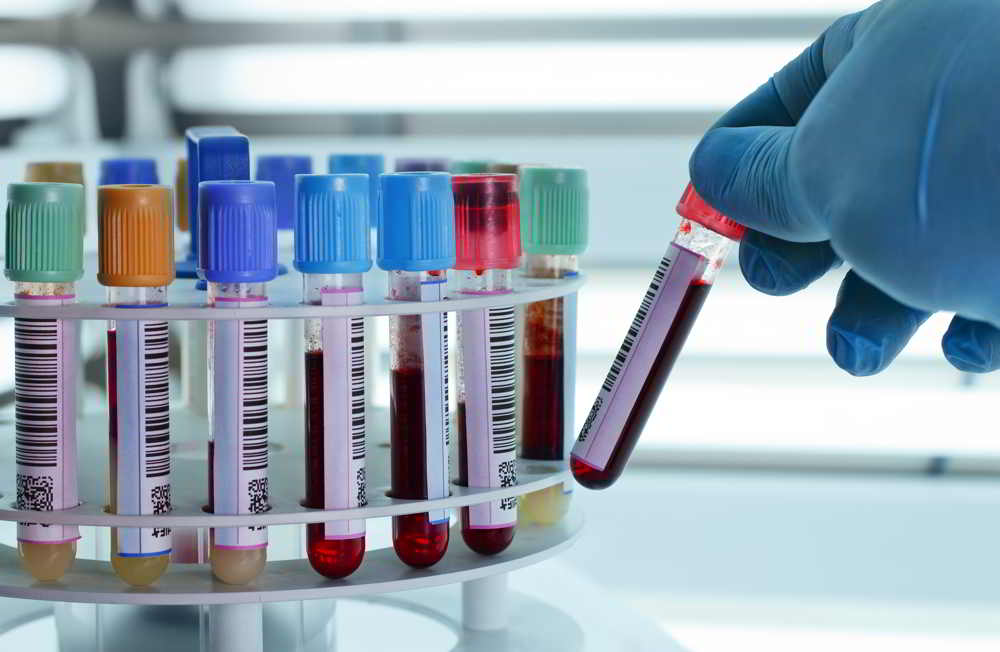 Vitamin B12 Test Price and Procedure Vitamin B12 Test Price and Procedure
