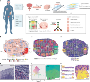 Spatial Transcriptomics And How It Is Changing Scientific Research