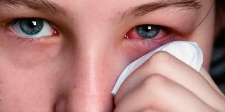 What Is Tear Trough Filler and Do I Need It?