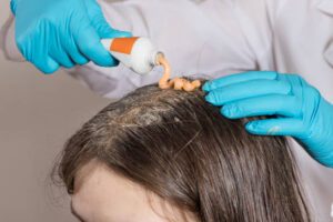 The Best Non-Surgical Hair Loss Treatments in New Jersey: What, How, and Where?