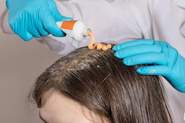 The Best Non-Surgical Hair Loss Treatments in New Jersey: What, How, and Where?