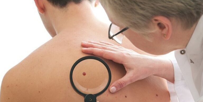 How to Choose the Right Plastic Surgeon in Long Beach CA & What to Know About Skin Cancer Treatment in Irvine CA
