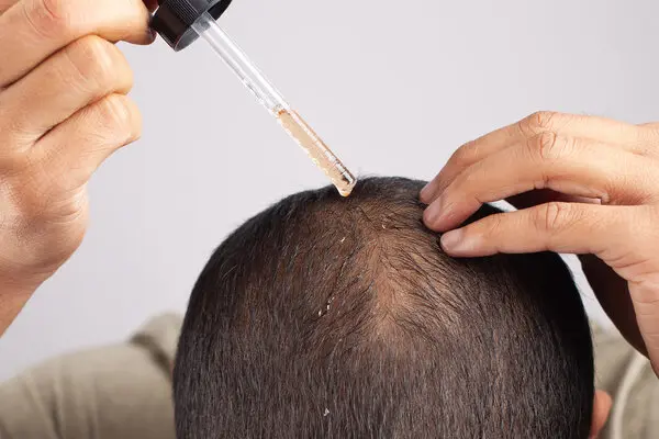 Hair Loss Treatment Options That Actually Work